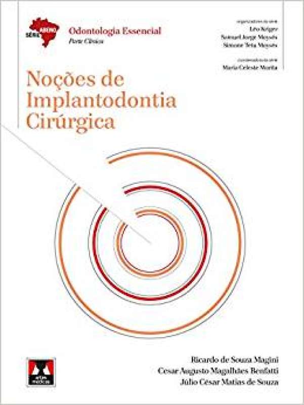  Nocoes de Implantodontia Cirurgica: 9788536702582: Ricardo de  Souza Magini e Outros: Books
